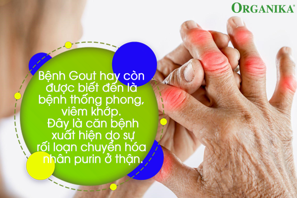 Gout là căn bệnh nguy hiểm, nếu không điều trị kịp thời có thể gây nhiều biến chứng nguy hiểm