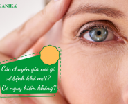 Các chuyên gia nói gì về bệnh khô mắt? Có nguy hiểm không?