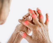 Bệnh Gout: Nguyên nhân, triệu chứng và cách chữa bệnh