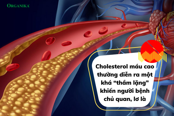 Nhiều người còn thờ ơ, chủ quan với tình trạng tăng cholesterol 
