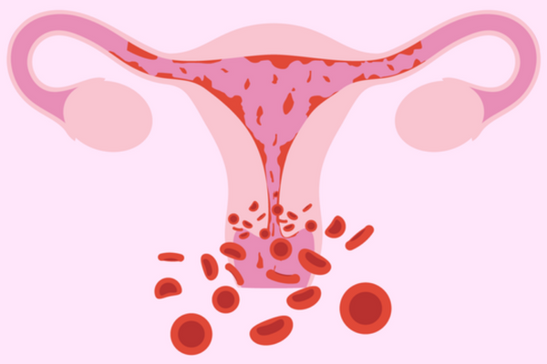 Ung thư cổ tử cung là một căn bệnh phổ biến hàng đầu ở phụ nữ trên thế giới
