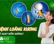 Bệnh loãng xương có nguy hiểm không?
