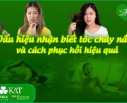 Dấu hiệu tóc cháy nắng và cách phục hồi hiệu quả, nhanh chóng Dấu hiệu tóc cháy nắng và cách phục hồi hiệu quả, nhanh chóng