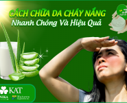 Cách chữa da cháy nắng hiệu quả nhanh chóng