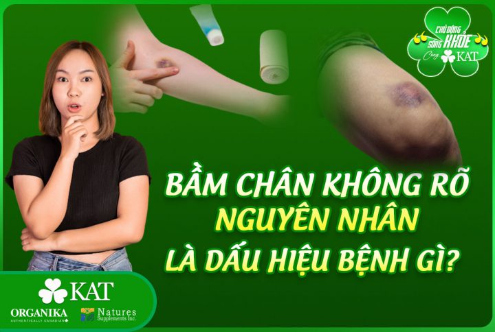 Bầm chân không rõ nguyên nhân là dấu hiệu của bệnh gì?