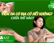 Viêm da cơ địa có hết không? Chữa thế nào?
