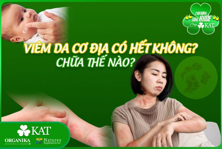 Viêm da cơ địa có hết không? Chữa như thế nào?