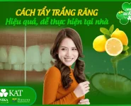 7 Cách tẩy trắng răng hiệu quả tại nhà dễ thực hiện 7 Cách tẩy trắng răng hiệu quả tại nhà dễ thực hiện