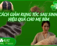 Cách giảm rụng tóc sau sinh hiệu quả cho mẹ bỉm